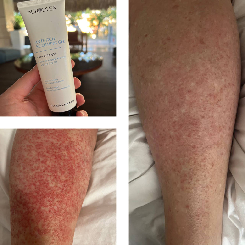 GEL APAISANT ANTI-DÉMANGEAISON - 75 ML