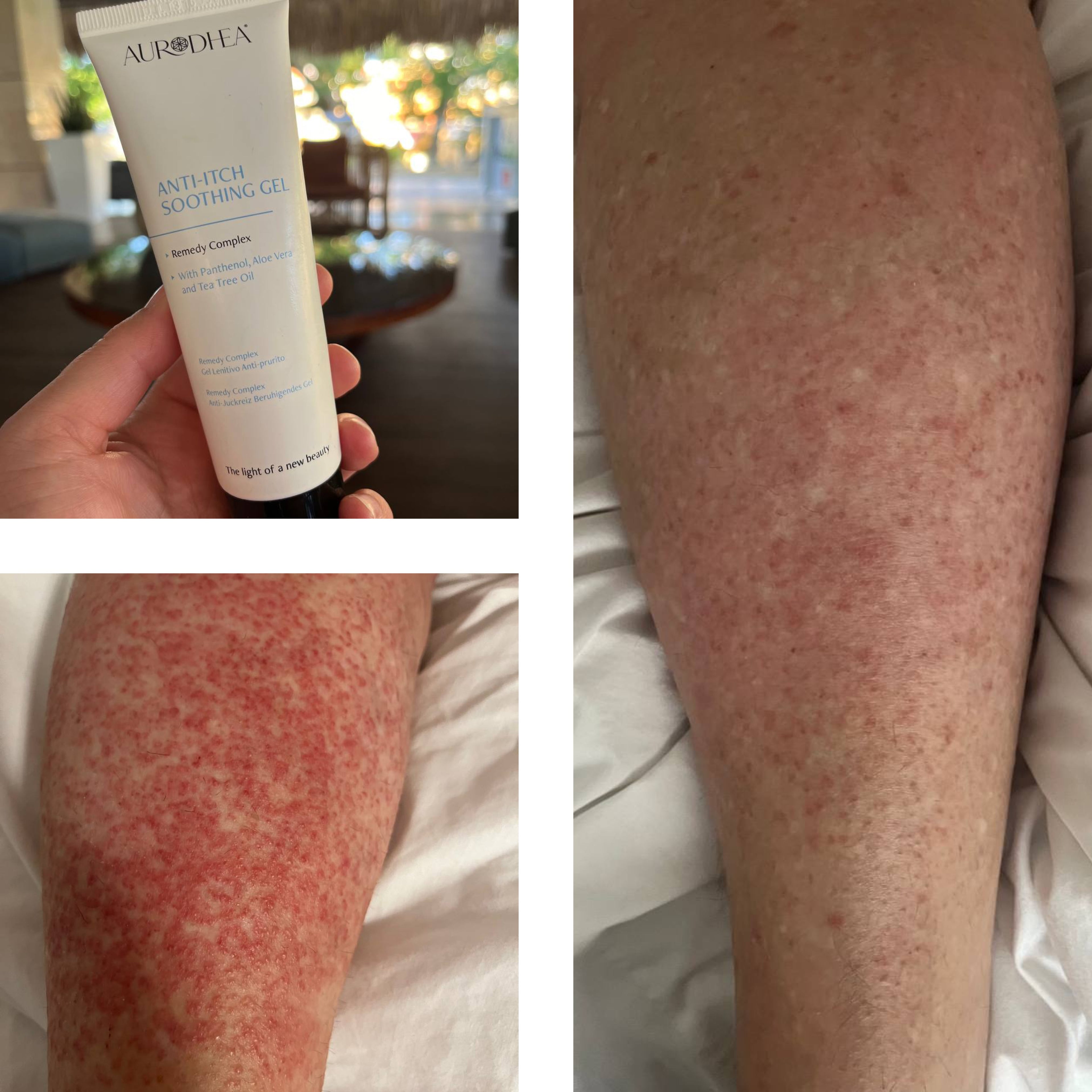 GEL APAISANT ANTI-DÉMANGEAISON - 75 ML